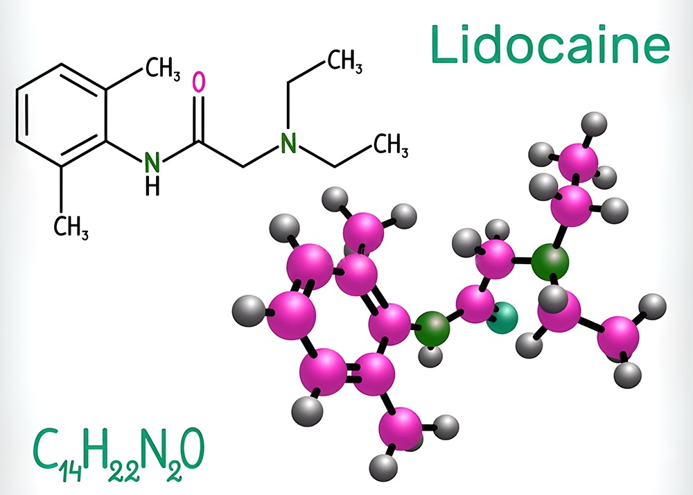 Lidocaine